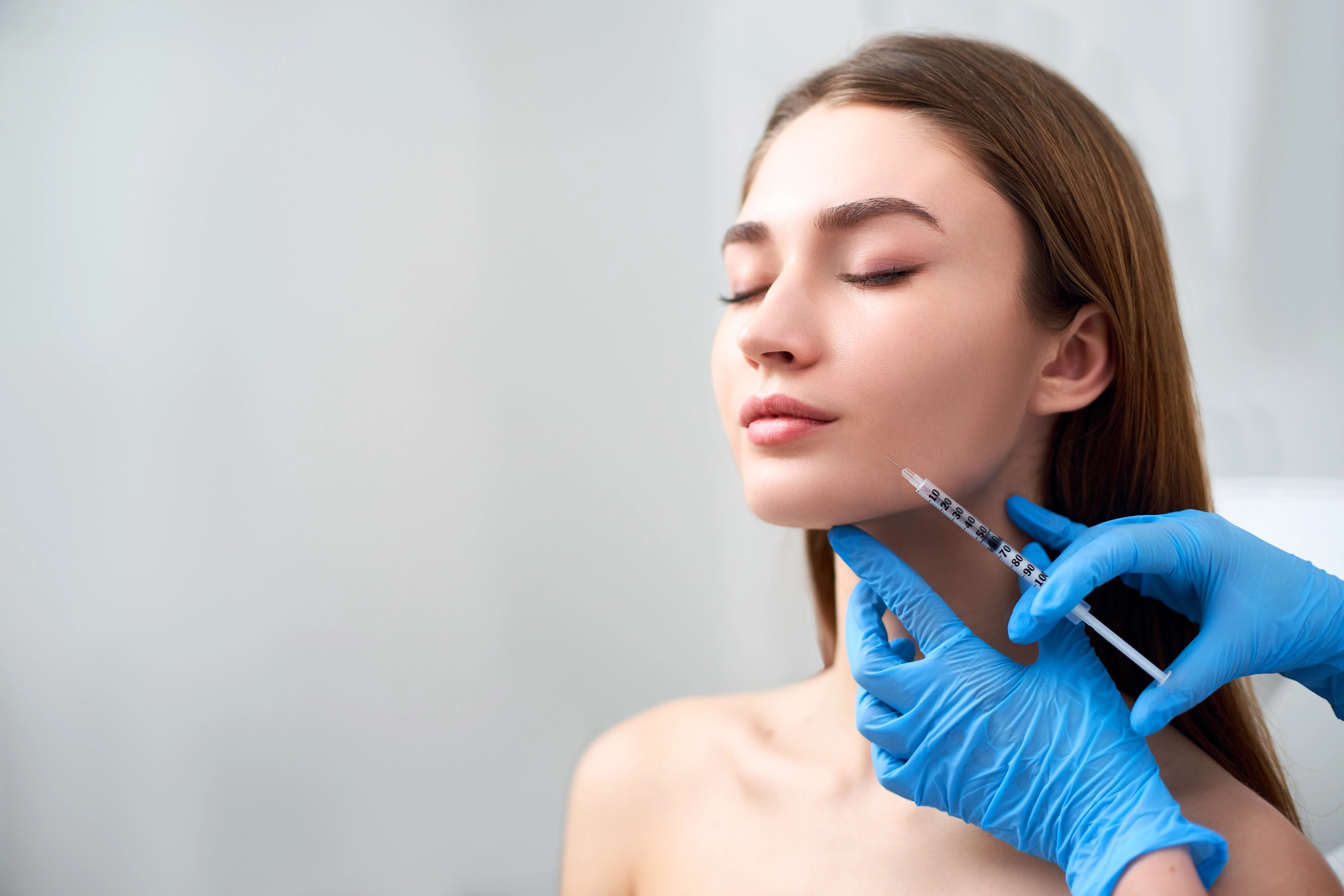 MArionette lines Radiesse - Cult Med Spa - Cult Med Spa onette lines Radiesse